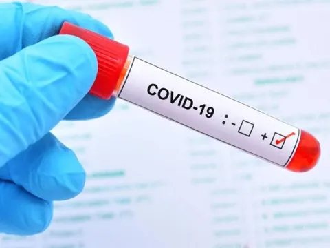 Xuất hiện biến chủng Covid-19 mới NB.1.8.1 ở TP Hồ Chí Minh